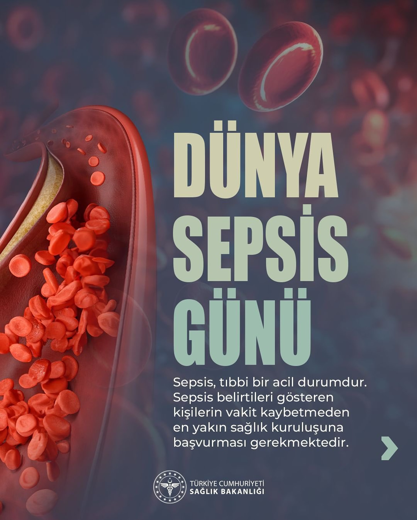 Sepsis Nedir ve Nasıl Tehlikeli Bir Durumdur?