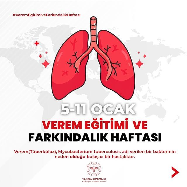 Tüberküloz Hastalığı ve Türkiye'deki Mücadele