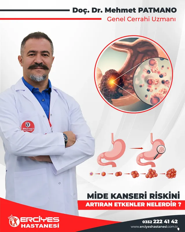 Erciyes Kartal Hastanesi: Mide Kanserinde Erken Teşhisin Önemi ve Risk Faktörleri